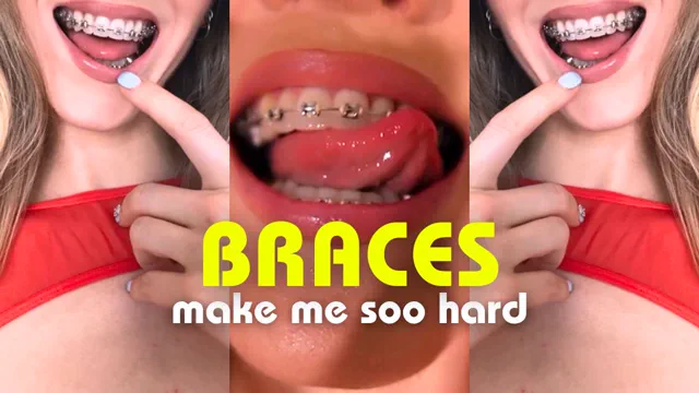 Braces make me soo hard